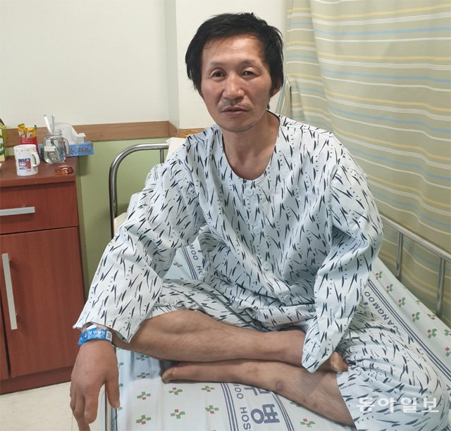 병원들의 떠넘기기 탓에 수술이 늦어져 팔을 절단하게 된 박정수 씨. 광주=이형주 기자 peneye09@donga.com