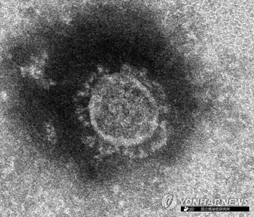 일본 국립감염증연구소가 분리한 코로나19 전자현미경 사진 [일본 국립감염증연구소 제공, 재판매 및 DB 금지]