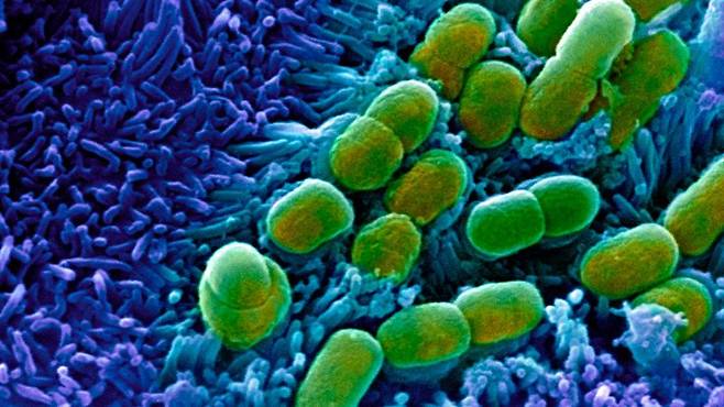 슈퍼박테리아 잡는 슈퍼항생제 개발 - 과학자들이 인공지능을 활용해 항생제 내성이 생긴 슈퍼박테리아를 잡을 수 있는 슈퍼항생제를 찾는데 성공했다. 사진은 전자현미경을 이용해 찍은 대장 속 대장균(녹색) 이미지네이처 제공