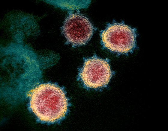 신종 코로나바이러스(코로나19) 전자현미경 촬영 사진 © 미국 국립 알레르기·전염병 연구소 로키마운틴 실험실 (NIAID-RML)