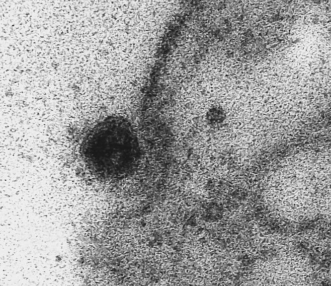 코로나19 바이러스(왼쪽 검은색 물체)가 세포핵에 들어가는 것 모습. 코로나19 바이러스는 숙주 세포의 핵에 침입해 자신의 유전자를 복제한 후 새로운 바이러스를 만들어낸다.  (사진출처=피오크루즈 재단 홈페이지)© 뉴스1