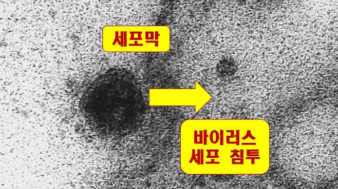 세포에 도달한 바이러스(검은 색 점)가 세포핵 막을 뚫고 들어가려는 순간. (사진=Debora F. Barreto-Vieira / IOC / Fiocruz)