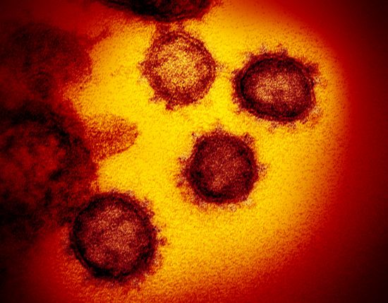 미국 국립보건원이 2월 발표한 신종 코로나바이러스(SARS-CoV-2) 전자 현미경 사진. AP연합뉴스