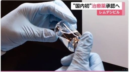 28일 후지뉴스네트워크(FNN)는 일본 정부가 다음달 초 렘데시비르를 코로나19 치료제로 특별승인할 수 있다고 보도했다. 사진=FNN방송화면 캡처