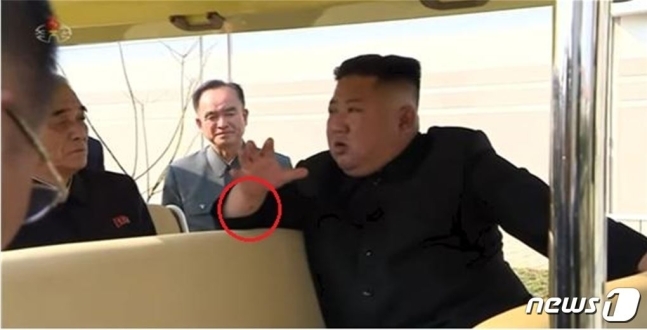 지난 1일 순천린(인)비료공장 준공식에 참석한 김정은 북한 국무위원장의 팔에서 확인된 검은 자국을 두고 심혈관 관련 시술 가능성이 제기되고 있다. (조선중앙TV 갈무리)/사진=뉴스1