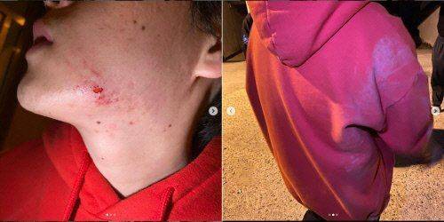 비프리, 킹치메인 폭행 혐의 입건. 사진=킹치메인 인스타그램