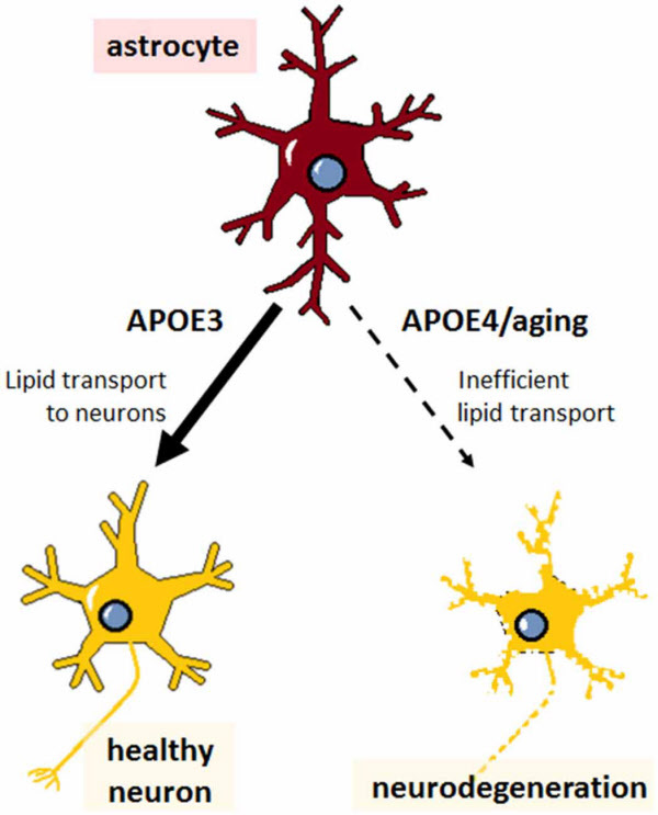 아포지단백E(APOE) 유전자가 APOE3 형이면 지질을 신경세포에 제대로 전달해 신경세포가 건강하지만 APOE4 돌연변이거나 노화로 지질 수송이 제대로 되지 않으면 신경세포가 파괴돼 치매를 유발한다고 알려졌다./Nature