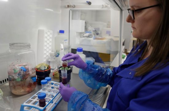 21일 영국 케임브리지 대학의 치료면역학 및 전염병 연구소에서 한 연구원이 신종 코로나바이러스 감염증(코로나19) 환자의 혈액 샘플을 실험을 위해 준비 중이다. AFP연합뉴스