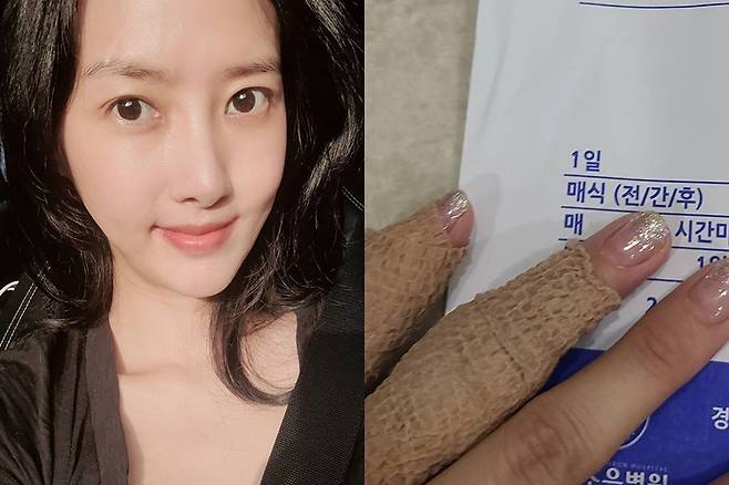 ▲ 이선정이 부상을 당했다. 출처ㅣ이선정 SNS