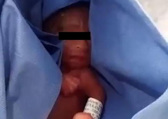 21일 멕시코 푸에블라시 라 마르게리타 병원에서 태어난 신생아로, 태어난 직후 사망 판정을 받았지만 6시간 만에 기적적으로 살아났다. 아기 아버지가 아기를 구조한 뒤 포대에 싸 안고 있는 모습. 연합뉴스