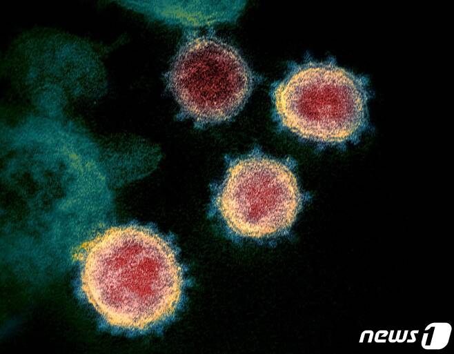 전자현미경으로 촬영된 신종 코로나바이러스(Covid-19) © AFP=뉴스1