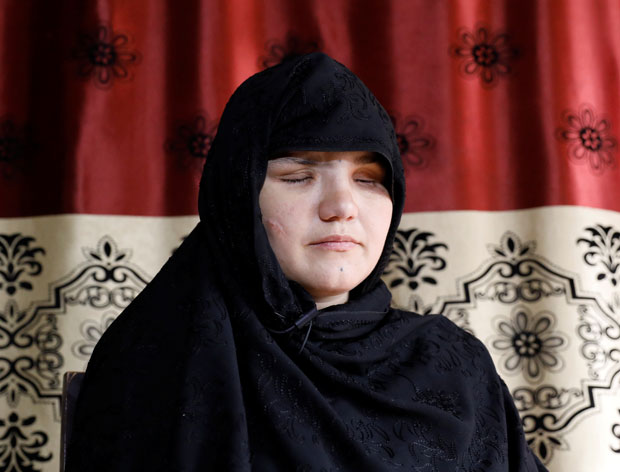 10일(현지시간) 로이터통신은 아프가니스탄 가즈니주 여자 경찰 한 명이 탈레반 무장괴한 공격으로 눈이 멀었다고 보도했다./사진=로이터 연합뉴스