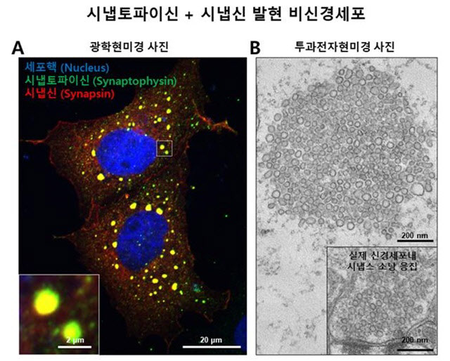 시냅토파이신과 시냅신에 의한 액체·액체 상분리 현상과 비신경세포에서의 시냅스소낭 응집 모사 구조 형성.(자료=한국연구재단)