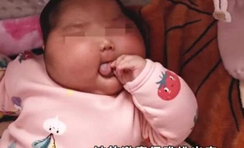 호르몬 함유된 유아용 크림 발라 얼굴이 부풀어 오른 중국 생후 5개월된 유아[바이두 캡처]