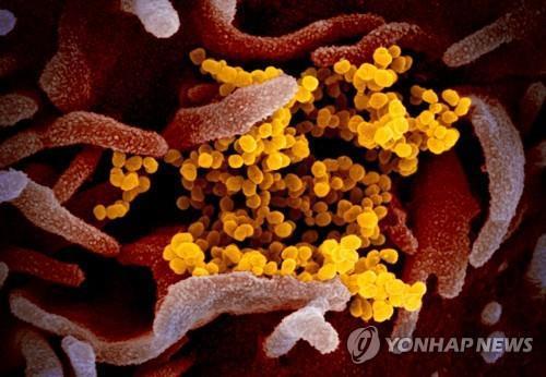 신종 코로나바이러스 감염증(코로나19) 바이러스를 전자현미경으로 촬영한 이미지. / 사진=연합뉴스