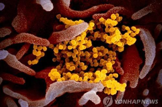 신종 코로나바이러스 전자현미경 이미지. 연합뉴스