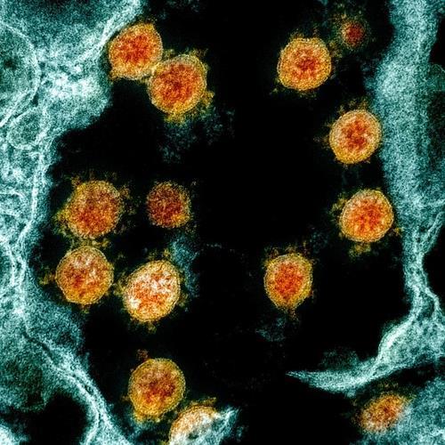 신종 코로나바이러스 환자의 감염 조직에서 분리한 신종 코로나바이러스 입자(오렌지색)  [미 NIAID 제공·NIH 홈페이지 캡처 / 재판매 및 DB 금지]