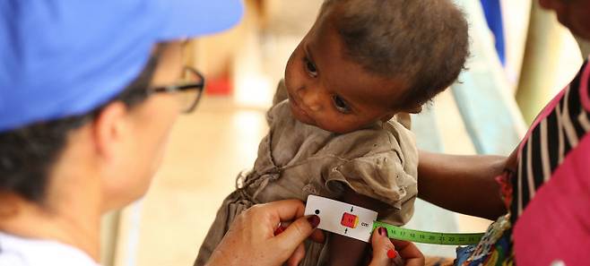 마다가스카르의 한 아이가 영양실조 검사를 받고 있다. 세계식량계획(WFP) 제공.