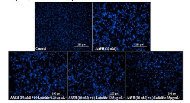 (서울=연하뉴스) 해수부 산하 국립해양생물자원관과 제주대학교 공동 연구팀은 지난해 10월 괭생이모자반에서 노화 방지에 효과가 있는 '로리오라이드'(Loliolide)라는 물질을 세계 최초로 찾아냈다. 사진은 형광현미경을 이용해 세포 보호효능을 측정한 모습. 2021.1.24.[해양수산부 제공. 재판매 및 DB금지] photo@yna.co.kr