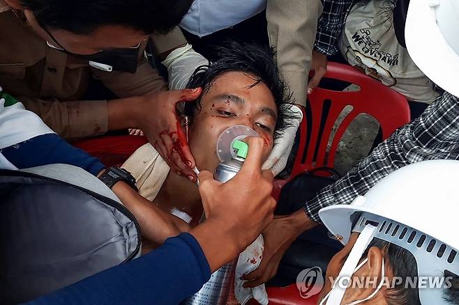 미얀마 남부도시 다웨이에서 28일 열린 반쿠데타 시위에 참여했다가 다쳐서 의료진의 치료를 받는 시민[AFP=연합뉴스]