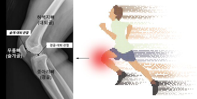 무릎 통증 관리를 위한 올바른 운동법 | 서울대학교병원
