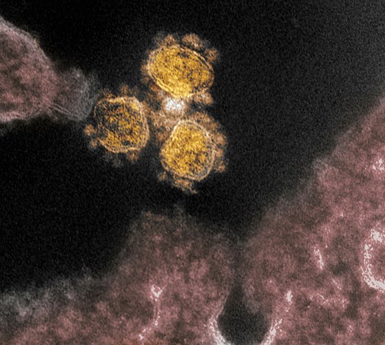 미국 국립 알레르기·전염병 연구소가 배포한 실험실 배양 코로나19 바이러스(노란색)의 모습. 표면에 스파이크 단백질이 솟아 있는 모습이 보인다.[AFP=연합뉴스]