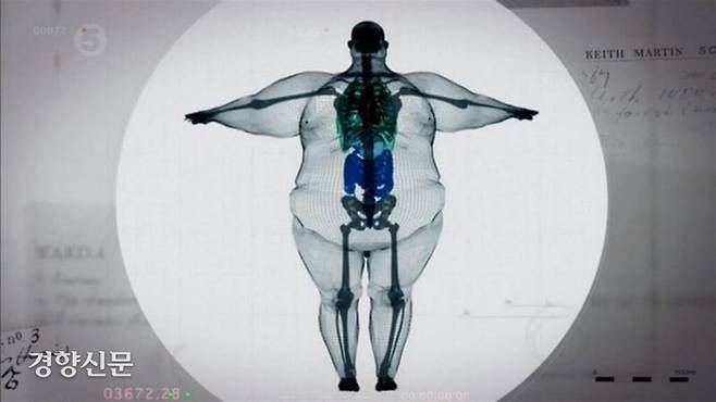 6월 29일 여러 인터넷커뮤니티에 ‘180㎏ 남성의 엑스레이 사진’이라는 제목으로 올라온 사진. 파란색으로 표시되어 있는 내장 등을 볼 때 CG가 아니냐는 논란이 일었다. /aagag