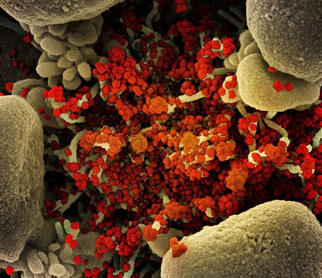 인체에 침투한 코로나 바이러스(붉은색)의 전자현미경 사진. 델타 변이 코로나 바이러스는 처음 출현한 코로나 바이러스보다 인체에서 1000배 이상 더 많이 증식하는 것으로 밝혀졌다./NIAID
