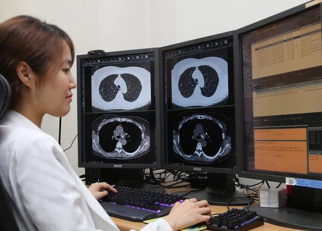 남주강 서울대병원 교수가 초저선량으로 촬영한 CT 영상을 AI 프로그램을 적용해 고품질로 보정하고 있다. 서울대병원 제공