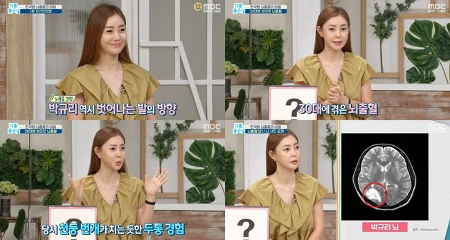 Cerebral hemorrhage Confessions...Thunder hits a severe headache (a good day)Singer Park Gyuri has energized the program with an extraordinary sense.Park Gyuri appeared on MBCs Pleasant Day, which aired at 9:45 a.m. on the 13th, and attracted attention by telling her experiences of cerebral hemorrhage as well as voluminous talks.Park Gyuri, who appeared as a guest on the day,I had a cerebral hemorrhage story and I had a serious headache like Thunder in my head. Since then, Park Gyuri has not only explained the story of the hospital quickly, but also released MRI photos and added richness to the contents.In addition, Park Gyuri asked about the relationship between stroke and emotional regulation, and he pointed out what viewers would be curious about. In the talk of their eating habits, they mentioned the favorite food such as tteokbokki, pork belly, and makchang.Park Gyuri, who has played a big role in various broadcasts such as Channel A Sanjeon Girls High School Alumni and MBN Paljabang along with his activities on Good Day, will continue his active activities in the future.