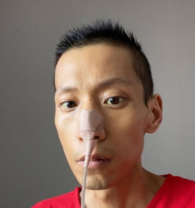 암 투병 사실을 알리며 권순욱 감독이 인스타그램에 올린 사진