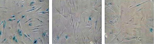 진세노사이드 처리 후 재생되는 사람 피부 섬유아세포 사진.  /기초과학지원연구원  제공