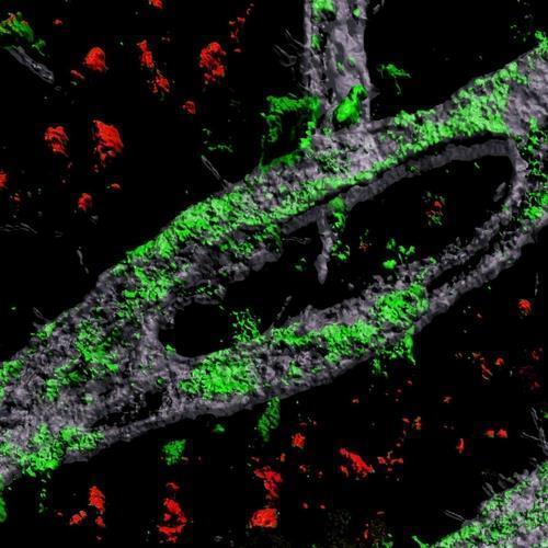 뇌에 침적된 아밀로이드 APOE 4 유전자형을 가진 생쥐 뇌의 혈뇌 장벽 혈관에 침적된 아밀로이드 단백질(녹색)
[MIT 피카우어 연구소 제공 / 재판매 및 DB 금지]