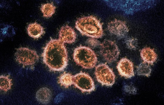미 국립알레르기·감염병연구소가 전자현미경으로 코로나19 바이러스를 확대한 모습. AP=연합뉴스