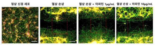 고배율 현미경 관찰 상 열상 손상을 가한 신경세포와 비교해 아파민을 처리한 신경세포에서는 아파민 농도가 높을수록 축삭돌기의 재생량과 길이가 증가했다