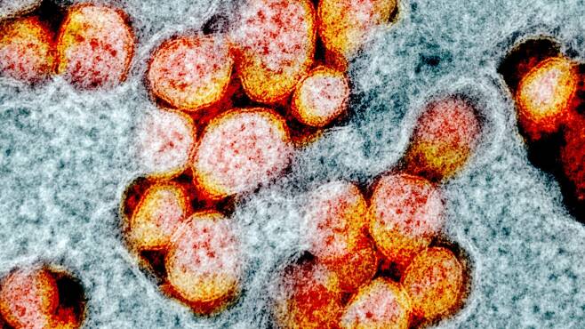 인체에 감염된 코로나 바이러스(주황색)의 전자현미경 사진./NIAID