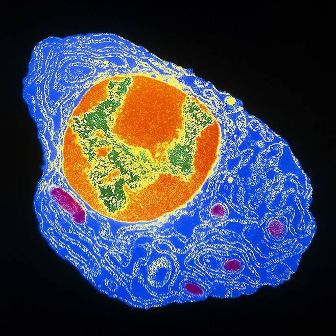 골수에 있는 형질 B세포의 현미경 사진. 코로나에 걸렸던 사람은 이 B세포가 골수에 자리잡고 계속 코로나 바이러스에 결합하는 항체를 생산한다./Nature