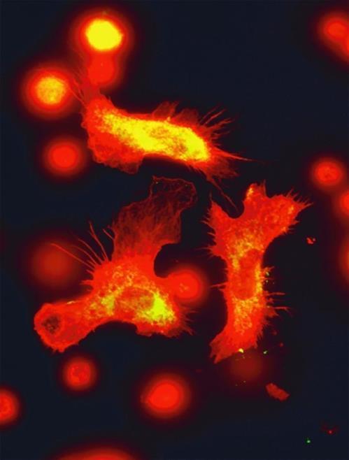 조혈모세포의 전자현미경 이미지  [독일 드레스덴 공대 지배케 교수 랩 제공 / 재판매 및 DB 금지]