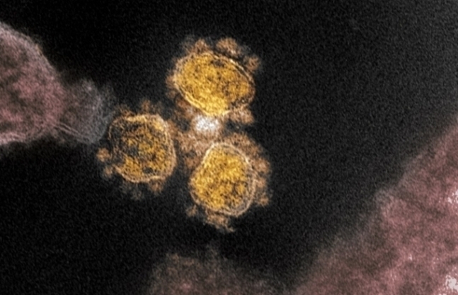 전자현미경으로 본 신종 코로나바이러스 감염증(코로나19). 사진=EPA연합