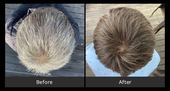 흰머리의 60대 남성이 모다모다 샴푸를 사용히기 전(왼쪽)과 8주 뒤의 모습, 갈변현상 때문에 머리카락이 흑갈색으로 변했다. [사진 모다모다]