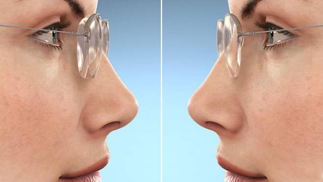 출처= specscart.co.uk