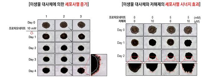 [대전=뉴시스] 왼쪽 그림은 3차원 세포배양 모델에서 프로피오네이트의 대장암 세포주 생장 억제 효과, 오른쪽은 프로피오네이트와 타겟 단백질 저해제 동시처리를 통한 생장억제의 시너지 효과.  *재판매 및 DB 금지