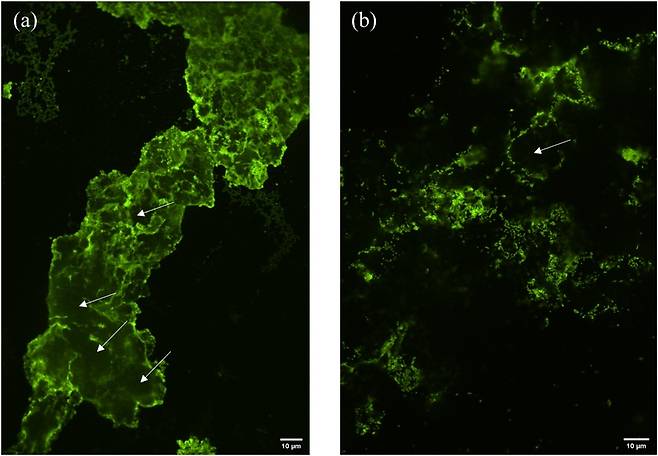공초점 현미경을 통해 미생물과 미세플라스틱(녹색)의 상호작용 관찰(KBSI 제공)© 뉴스1