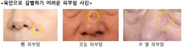 자료제공=고려대안암병원