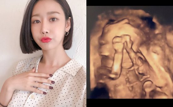 The second was pregnancy by the golden (songboram) from Crayon Pop.On the 16th, Kummi released a picture of the fetal ultrasound with his article I will give the second news of Careful after leaving D-100 days before birth 100 days ago in his instagram.I am very excited about the fact that I have a lot of good boats and I feel active in my birth, said the 25-week-old pregnancy.I thought about my second thought, but I did not know how to come so soon, so I made my mother, Father, and I made Taemyung Shimkung. Tomorrow, I am going to change to double digits.It is my mothers heart that I want to get along well with both the universe and the heart.Geummi made her debut as a girl group Crayon Pop in 2012; turned actor in 2017 and appeared in the web drama The Six People Room and the drama The Mugunghwa Flowers have Flowered.In February 2020, he married a non-entertainer who was a businessman, and he was the first in August of the same year.100 days before birthCareful, with D-100 days left, Ill give you the second newsToday is 25 weeks and 5 days, but it is nowadays that I feel a lot of boats and I feel active in my life.I had a second thought, but I did not know how to come so soon, so I made my mother Father heart beat.Tomorrow, it will be changed to double digits.Now shes a mother who only raises her 3-year-old sonIm already worried about how to raise two childrenThe universe is so young that the moment your brother was bornI was so excited to think that I should share love(Ill hug and love you more tomorrow.)Im sure the universe and the heartbeat are all in good shapeIm sorry I want you to get along.Ill congratulate you on being your brother and ask you for your heartbeat.#sons daughtera heartless heartPhoto = The Golden Instagram