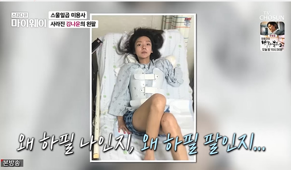 Kim Na-yoon appeared in My Way and overcame the pain and crisis after the accident and told the story like a myth that made four fitness champions.Behind her, the sacrifice and love of the support of her were conveyed, adding to the delicacy.On the 20th, TV star documentary My Way, Kim Na-yoon, who is called the indomitable Venus, appeared.I met the indomitable Venus and Kim Na-yoon who became the champions of the arm fitness team on the day.I was grateful for my survival, he said, as he Top Model himself by competing in all competitions, even though he became an acquired disabled person.He said, I lost my arm in an accident four years ago. At the age of 27, I had a motorcycle accident. I slipped on the national highway, rolled, and my arms were cut off. Since then, I have been reminded of the time when I won the first champion of the disabled and won the championship trophy with one arm.He said, Despite the absence of one arm, many people cheered me up.Thats how much her Top Model sounded to many.He also said, I came home and I was afraid that I would have a lot of time to live alone because I had no real life and no family. I chose my life for being alone. I did not have anything easy from one to ten.Carefully, I asked when the accident occurred in 2018.I do not lose my consciousness and I am remembering it, he said. I went out to Chuncheon to get a wind, but the transportation was slipping on the national highway while going with my motorcycle Friends.I thought I just fell, but my Friend cried because I did not have an arm, I wanted to hear it, I just fell down, he said. I felt like I had no real arm, and my left side did not move.There were 19 fractures from the cervical vertebrae to the thoracic vertebrae. Even I could not get up because my neck broke.I imagined a terrible accident scene.He said, My Friend came to my arm because I was worried that my arm would be so rotten that I could not join it, and I went to the emergency room near Chuncheon.In addition, it is sad news that I had to cut again because of sepsis even though I had junction.Kim Na-yoon, a hairdresser, said, My left hand is an important role for me. My goal and dream, the Feelings that I have been doing so far, the frustration has begun. I cried at the hospital. If it was a car or a train, I thought.He said, I wanted to be grateful for the right answer, so I found gratitude in despair. I would have died instantly if my arm had blown, and I am grateful for that part.Kim Na-yoon, who said that only the spine became worse after the accident, started the day with stretching such as the body symmetry does not fit, and the pin was put on the thoracic vertebrae after the accident.I aim to study and exercise, he said.However, he said, I watched the mirror while watching the mirror after the accident. I saw the whole picture. Of course, I had a strange Feelings because I did not have an arm. I lived with my arms for 27 years, I have only four years of my arm. I will get used to it. Above all, she revealed her prosthetics. If you wear silicone skin, you will hardly get any tee. If you wear a T-shirt, you will not get a real tee.However, he said that the first Top Model to confront the disability was to take off his hand. I was worried about peoples eyes and hesitated a lot in front of the door, but I was confronted with myself.He said, I Top Model fitness to accept myself. He Top Model the prejudice, so he competed with the non-disabled and won the first trophy, and won all the events and achieved four fitness titles.Above all, about his mother, who is the first person in the world, he said, My mother, who showed a strong appearance when she changed her diaper and re-cut her arm.I saw my mother crying for the first time after the accident.  Shiya can only see the ceiling, but my mother collapsed. I felt like I was lying down, I should not be embarrassed. His mother also said, My daughter was a severed accident at a young age. I could not accept it. Suddenly I was disabled and I was hard to feel. I focused on you 24 hours from eating the Feelings of returning to a newborn baby 27 years ago to digestion. I slept for 5 minutes and 3 minutes. Especially in the period when the fantasy was severe, the mother and daughter were hard on each other.My mother said, My mother was not in the right mind, my 19 fractured daughter, prayed for Na Yoon Lee, and prayed for me to walk.Fortunately, Kim Na-yoon is alive and walking again.My mother said, Now I am proud, thankful and wonderful, but I am worried that the more I live, the more I have to worry about the pain. Kim Na-yoon said, I live well because of my mothers care, I love you again.Finally, Kim Na-yoon said, Everyone can be immediately in a day, so I think my body is like Venus of Milo.When I revealed it as it is, it is the most natural, wonderful and beautiful. Now I have named it Yoonus, he said.It is important to be in the body every day because it does not matter if it fails to be a Top Model, he said.Its a steady one, he added.My Way capture