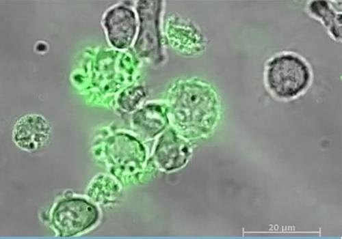 NK세포의 암세포 검문 암세포(녹색)의 존재를 면역계에 알리기 위해 외막 조각을 뜯어내는 NK세포.
[캐나다 오타와대 연구팀의 2022년 4월 13일 '사이언스 어드밴시스' 논문 캡처. 재판매 및 DB 금지]