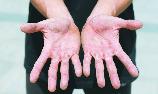 김 코치의 손. 17년 간의 파쿠르로 생긴 굳은살이 가득하다.