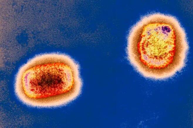 원숭이 두창 바이러스의 전자현미경 사진. 최근 영국과 유럽, 북미에서 환자가 잇따라 나왔다./영국 공중보건안전청