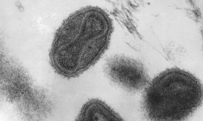 원숭이두창과 같은 계통인 천연두 바이러스. 안에 있는 유전물질 DNA가 아령 모양을 하고 있다. 위키미디어 코먼스